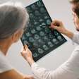 Será que essa bactéria comum nos olhos pode estar causando a doença de Alzheimer?