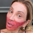 Maya Massafera volta a aparecer com o rosto queimado e explica