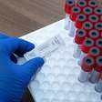 Sífilis: doença prevenível volta a crescer e preocupa especialistas no mundo todo