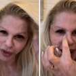 Monique Evans mostra rosto uma semana após ser 'atropelada por caminhão'