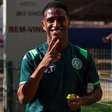 Jogador da Chapecoense sofre múltiplas fraturas e passa por cirurgia