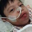 Uma cirurgia para Nathan: esperança em meio à luta contra a desnutrição