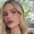 Yasmin Brunet mostra hematomas nas pernas causados pelo lipedema