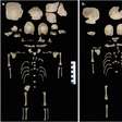 Há 1.200 anos, alguém decidiu proteger dois bebês gêmeos escondendo-os em um lugar improvável: latrinas ao lado do Templo de Artemis