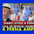 Lula não teve uma perna amputada; postagem com alegação falsa usa imagens manipuladas