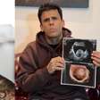 Após diagnóstico de insuficiência renal, 'homem mais tatuado do Brasil' descobre tumor na bexiga