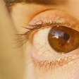 Anemia pode ser detectada pelos olhos com nova tecnologia; entenda