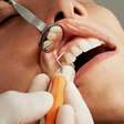 Pesquisa associa nanoestrutura de dentes à evolução da dieta humana