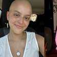 Sarcoma de Ewing: entenda o câncer diagnosticado em 12 crianças do mesmo bairro