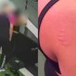 Mulher denuncia assédio após ser mordida e agarrada por instrutor de academia em Pernambuco