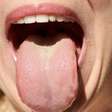Saliva pode dar pistas sobre câncer de intestino