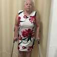 A luta de Maria de Lourdes: Cirurgia de artroplastia total do quadril
