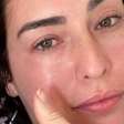 É grave? Fernanda Paes Leme relata susto na saúde e médico avalia: 'Cirurgia'