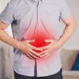 Azia frequente pode ser sinal de doenças digestivas; saiba quando procurar ajuda