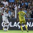 Santos é denunciado no STJD após cusparada de torcedor em jogador do Mirassol; veja a possível pena