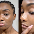 Erika Januza relata reação alérgica e mantém rotina nas gravações