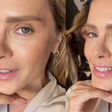 Carolina Dieckmann revela novo visual após procedimento de R$ 28 mil