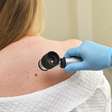Terapia combinada mantém uma redução de 49% no melanoma após 5 anos