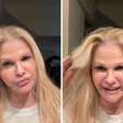 Monique Evans celebra resultado de plástica após superar rosto 'atropelado por caminhão'