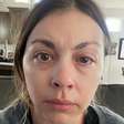 Mulher descobre doença ocular causada por maquiagem
