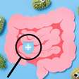 Disbiose: sintomas, causas e como tratar o desequilíbrio intestinal