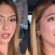 É grave? Mari Menezes revela diagnóstico de doença rara na pele