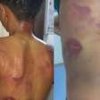 Pai espanca filho de 13 anos por usar brincos em Pernambuco: "Era para eu ter matado ele"