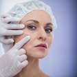 Lifting facial: 7 coisas que você precisa saber antes de fazer