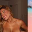 Após mais de um mês com coceira, Mari Menezes descobre doença rara e desabafa: 'Pode ficar comigo para o resto...'