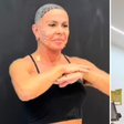 Gretchen faz procedimentos no rosto e no corpo após transplante capilar: 'Resultado incrível'