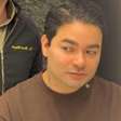 Yudi Tamashiro se submete a harmonização facial aos 34 anos; confira o antes e depois