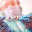 Universidades brasileiras participam de estudo internacional em busca da cura da hepatite B