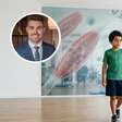 Distrofia muscular de Duchenne: o que a terapia gênica já mostra