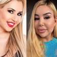 Cantora trans portuguesa revela consequências do silicone industrial e quase R$ 1 milhão em cirurgias