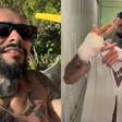 Famoso perde dedo ao pular grade no 'Rock in Rio' e assusta com decisão sobre o membro; assista
