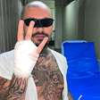 Streamer tenta invadir Rock in Rio, perde dedo e mostra acidente em live