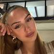 Miss Áustria morre aos 22 anos; modelo passou por 7 cirurgias cardíacas