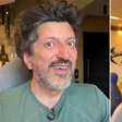 Veja como funciona o remédio experimental importado para o tratamento de Lito Sousa
