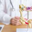 Pólipos intestinais: causas, sinais e prevenção do câncer colorretal
