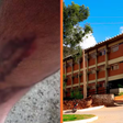 UFRPE é condenada a indenizar estudante atacado por cães dentro de campus em Serra Talhada