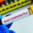 Vírus HTLV-1 causa síndrome inflamatória em assintomáticos, aponta estudo