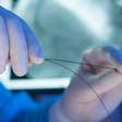 Nova técnica pode desobstruir artérias calcificadas sem uso de stent