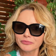 Rita Guedes conta o que aconteceu após blefaroplastia e revela que correu risco de perder a visão