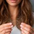 Queda de cabelo: 5 sinais de que é hora de consultar um especialista