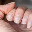 5 hábitos que estão deixando suas unhas fracas sem você perceber