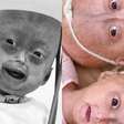 LUTO! Influenciadora Elis Lima, gêmea de Eloá, morre aos 5 anos; saiba causa do óbito