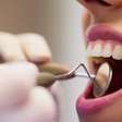 Sangramento na gengiva pede avaliação, alerta dentista