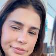 Como ficou o novo nariz de Simone Mendes? Resultado divide opiniões e cantora revela intimidade com Kaká Diniz: 'Ele me acha a mulher mais linda do mundo'