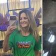 Após ensaio no 'Dança', Ticiane Pinheiro mostra ferimentos e hematomas: 'Dando meu sangue'