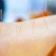 Acupuntura auxilia no alívio de sintomas da quimioterapia, apontam estudos